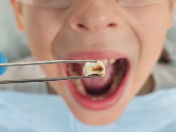 Best Same-Day Emergency Dental Services in St Martins, MO